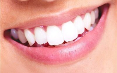 Si quieres unos dientes blancos es imprescindible que el dentista sea quien aplique y controle el tratamiento