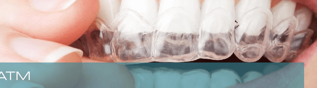 ¿Tú también rechinas o aprietas los dientes? ¡Tenemos la solución!