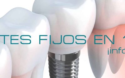 ¿Dientes fijos en un día? Infórmate. Ven a vernos ;)