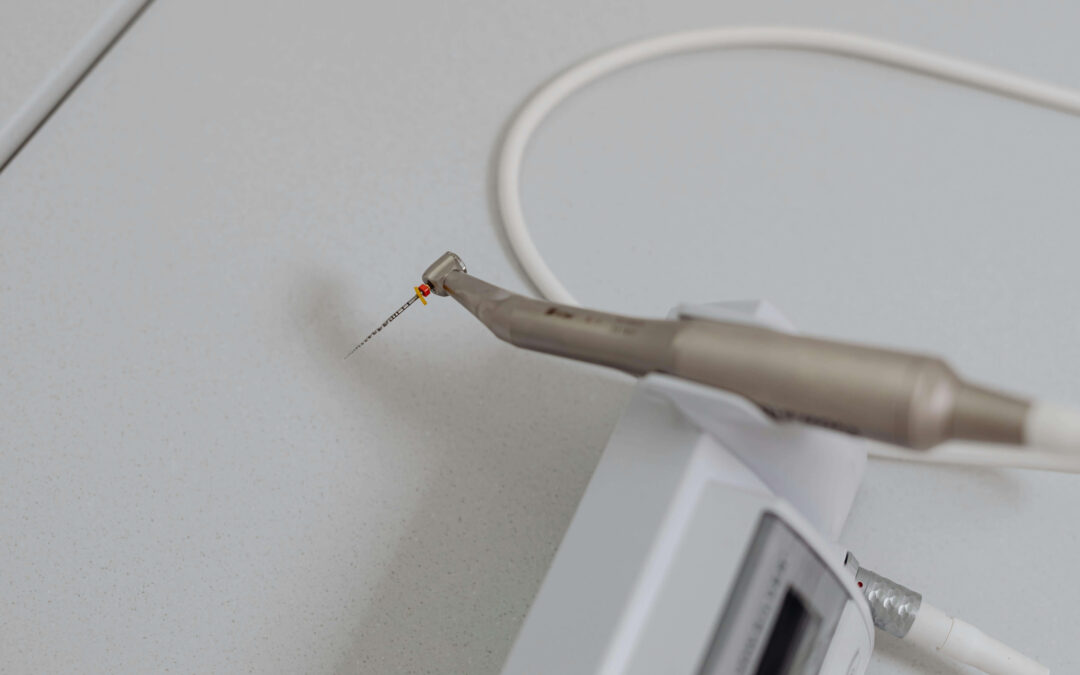 ¿Las endodoncias duelen mucho? Mitos, realidad y cómo se realiza el tratamiento